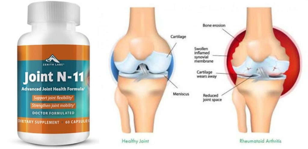 Review of Joint N-11